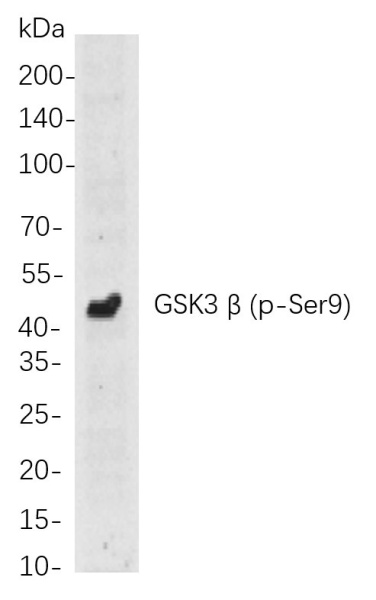 Recombinant Phospho-GSK3 β (Ser9) Monoclonal Antibody (AN301061L)