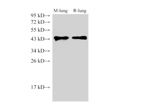 CD38 Polyclonal Antibody (D-AB-10189L)