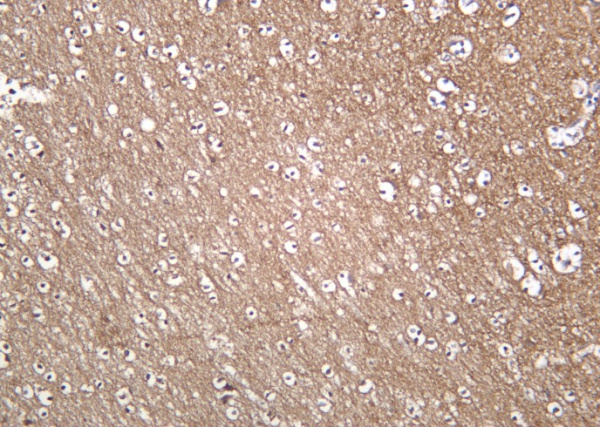 Recombinant Trk A Monoclonal Antibody (AN301287L)