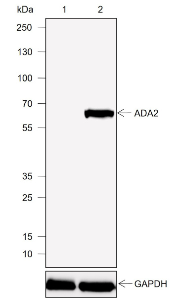 Recombinant ADA2 Monoclonal Antibody (AN302007L)