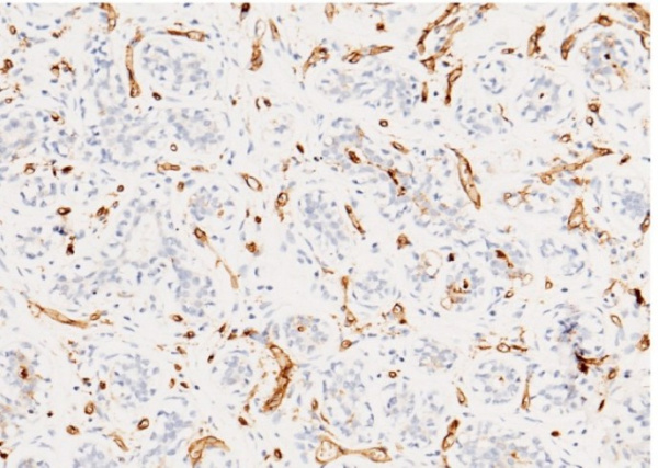 CD36/SCARB3 Monoclonal Antibody (AN200108P)