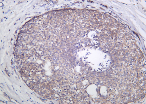 Recombinant GCN2 Monoclonal Antibody (AN301250L)