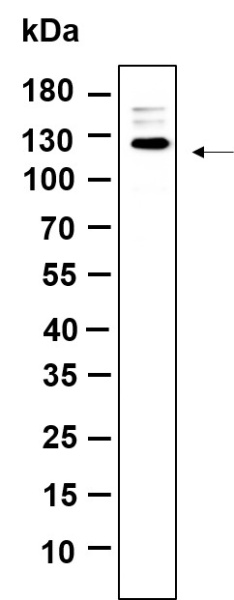 Recombinant Rb Monoclonal Antibody (AN301387L)