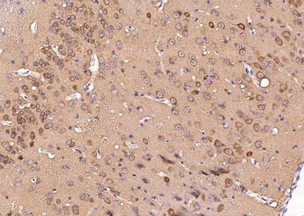 Recombinant S100A5 Monoclonal Antibody (AN300517P)