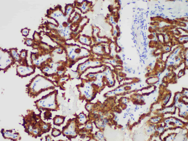 Galectin-3 Monoclonal Antibody (ELAB6918-M)