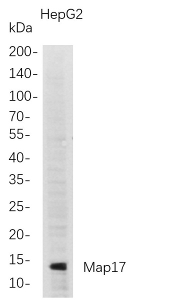 Recombinant Map17 Monoclonal Antibody (AN300777L)