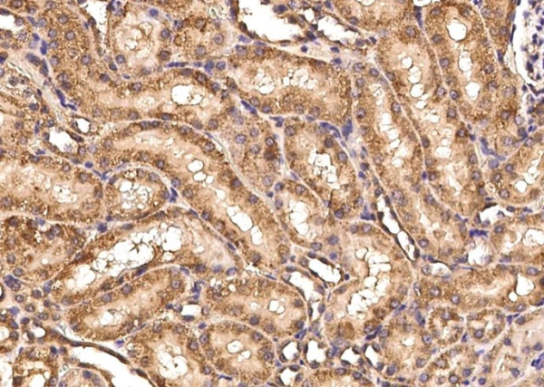 CD297 Monoclonal Antibody (AN200255P)