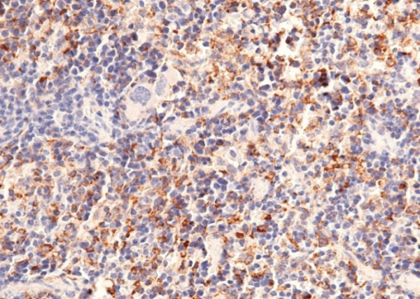 Recombinant CD302/CLEC13A Monoclonal Antibody (AN300166P)