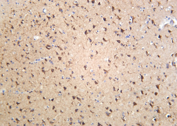 Recombinant Sortilin Monoclonal Antibody (AN301166L)