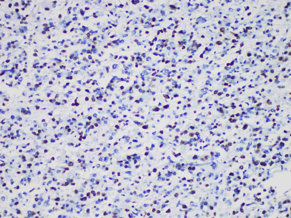 Olig2 Monoclonal Antibody (ELAB6938-R)