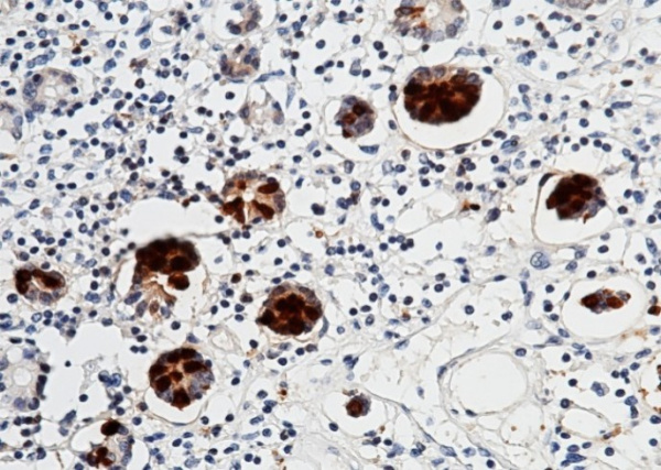 Recombinant REG3A Monoclonal Antibody (AN300113P)