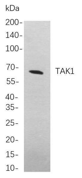 Recombinant TAK1 Monoclonal Antibody (AN300959L)