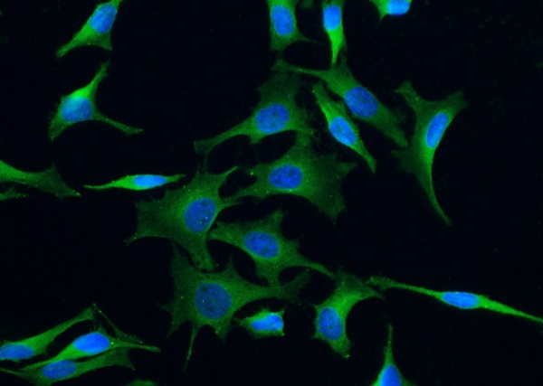 TrkC/NTRK3 Monoclonal Antibody (AN200161P)