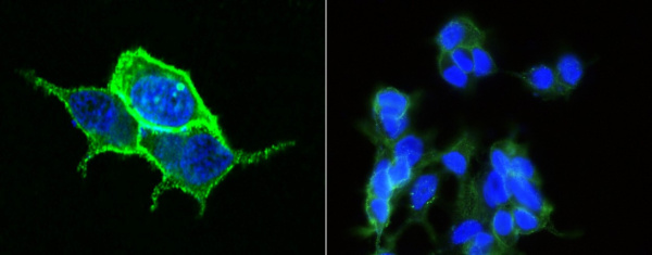 Carbonic Anhydrase XII/CA12 Monoclonal Antibody (AN200181P)