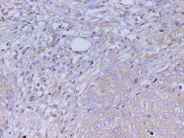 KLK2 Polyclonal Antibody (D-AB-10371L)