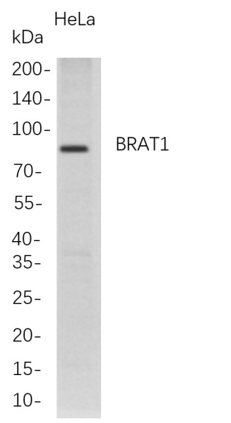 Recombinant BRAT1 Monoclonal Antibody (AN300775L)