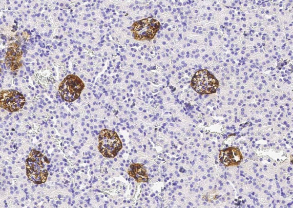 Recombinant Podoplanin/PDPN Monoclonal Antibody (AN300498P)