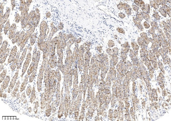 Claudin18.2 Monoclonal Antibody (AN200149P)