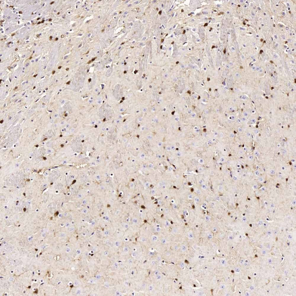 S100B Polyclonal Antibody (E-AB-70296)