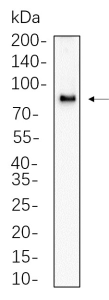 Recombinant CPT1A Monoclonal Antibody (AN300662L)