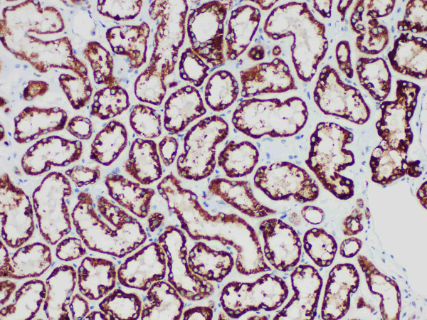 STAT6 Monoclonal Antibody (ELAB6947-R)