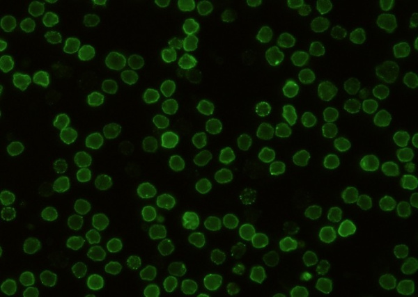 Recombinant CD48/SLAMF2 Monoclonal Antibody (AN300516P)
