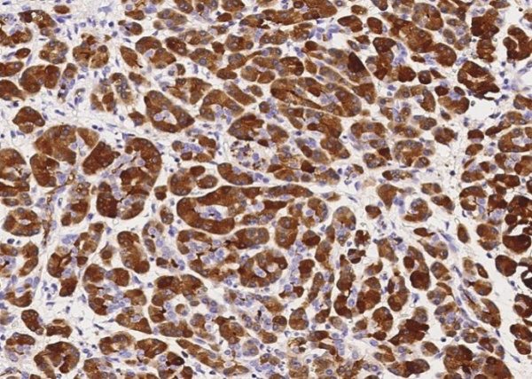 Recombinant CLPS/Colipase Monoclonal Antibody (AN300271P)