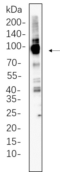 Recombinant Calnexin Monoclonal Antibody (AN301331L)