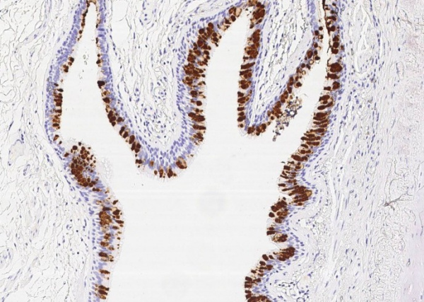 Recombinant BPIFB1/LPLUNC1 Monoclonal Antibody (AN300438P)