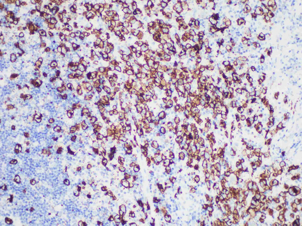 CD30 Monoclonal Antibody (ELAB6719-R)