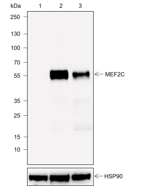 Recombinant MEF2C Monoclonal Antibody (AN302041L)