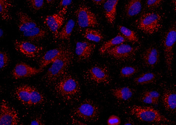 Recombinant Angiopoietin-2/ANG 2 Monoclonal Antibody (AN300346P)