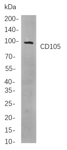 Recombinant CD105 Monoclonal Antibody (AN301090L)