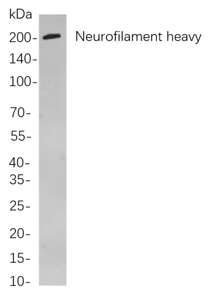Recombinant Neurofilament heavy polypeptide Monoclonal Antibody (AN301031L)