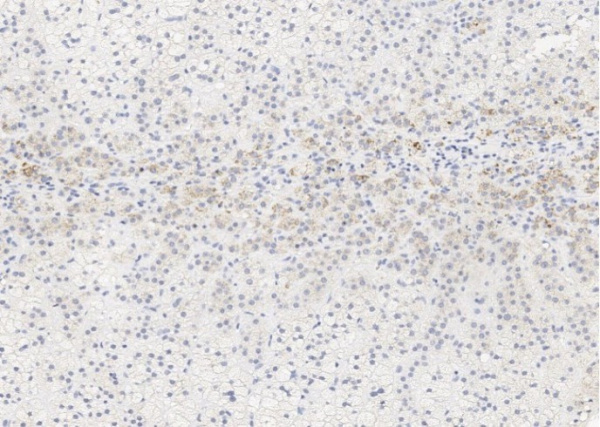 Recombinant Alkaline Phosphatase/ALPL Monoclonal Antibody (AN300090P)