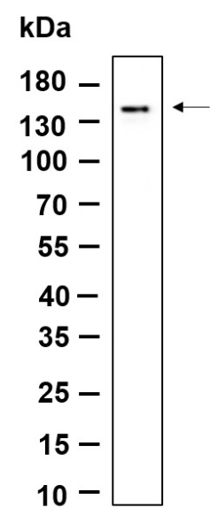 Recombinant MDA5 Monoclonal Antibody (AN301187L)
