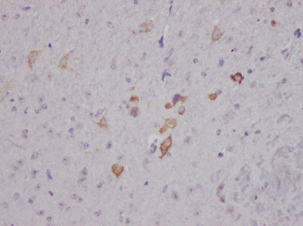 Nesfatin-1/Nucleobindin-2 Polyclonal Antibody (AN005880L)