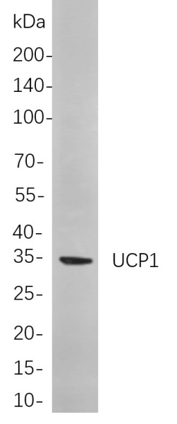 Recombinant UCP1 Monoclonal Antibody (AN301059L)