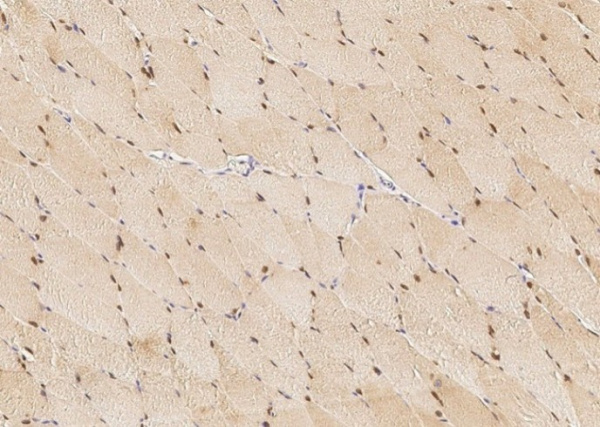 Recombinant BMI1 Monoclonal Antibody (AN300141P)