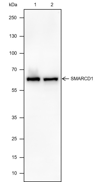 Recombinant SMARCD1 Monoclonal Antibody (AN301799L)