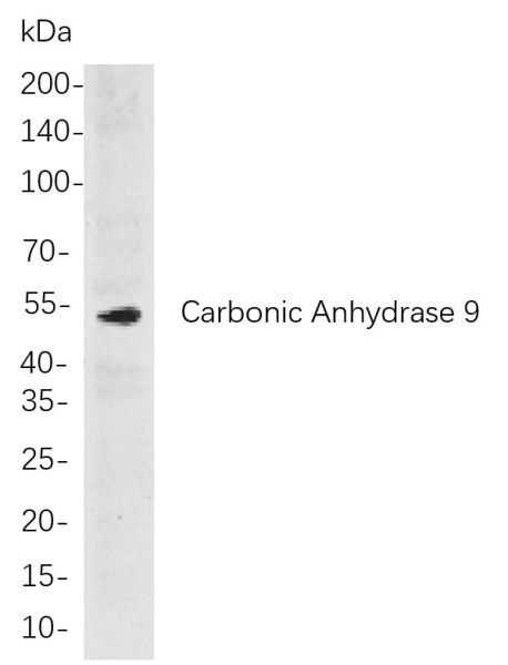 Recombinant Carbonic Anhydrase 9 Monoclonal Antibody (AN301053L)