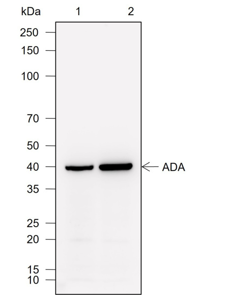 Recombinant ADA Monoclonal Antibody (AN302037L)