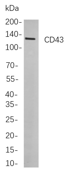 Recombinant CD43 Monoclonal Antibody (AN300848L)