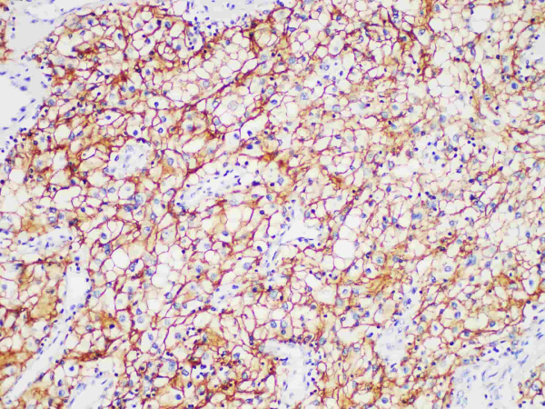 CA IX Monoclonal Antibody (ELAB6951-M)