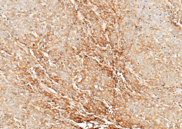 Recombinant CLEC3B/Tetranectin Monoclonal Antibody (AN300062P)