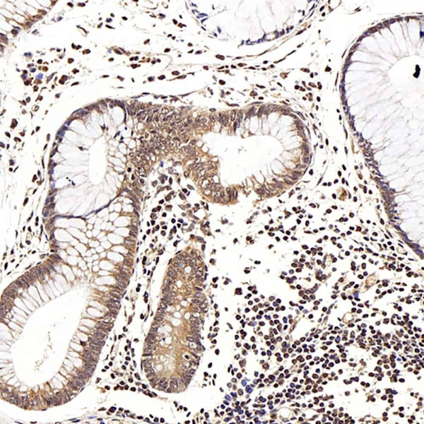 LEP Polyclonal Antibody (E-AB-70170)