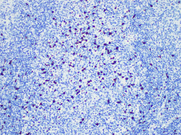 CD57 Monoclonal Antibody (ELAB6953-M)