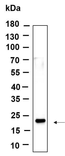 Recombinant Histone H3 (Di Methyl Lys36) Monoclonal Antibody (AN301170L)