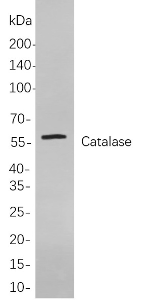 Recombinant Catalase Monoclonal Antibody (AN301085L)
