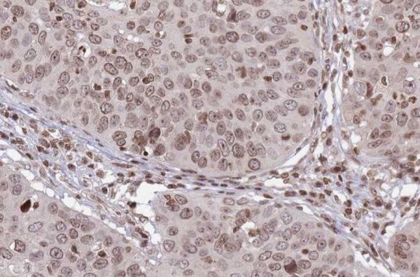 HPV16 Monoclonal Antibody (ELAB6930-R)
